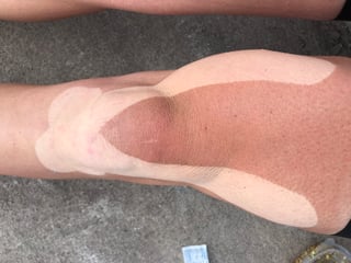 Tanned knee with pale stripes where kinesio tape had been, the sharp tan lines after a week of sun on the TransAtlantic Way.
