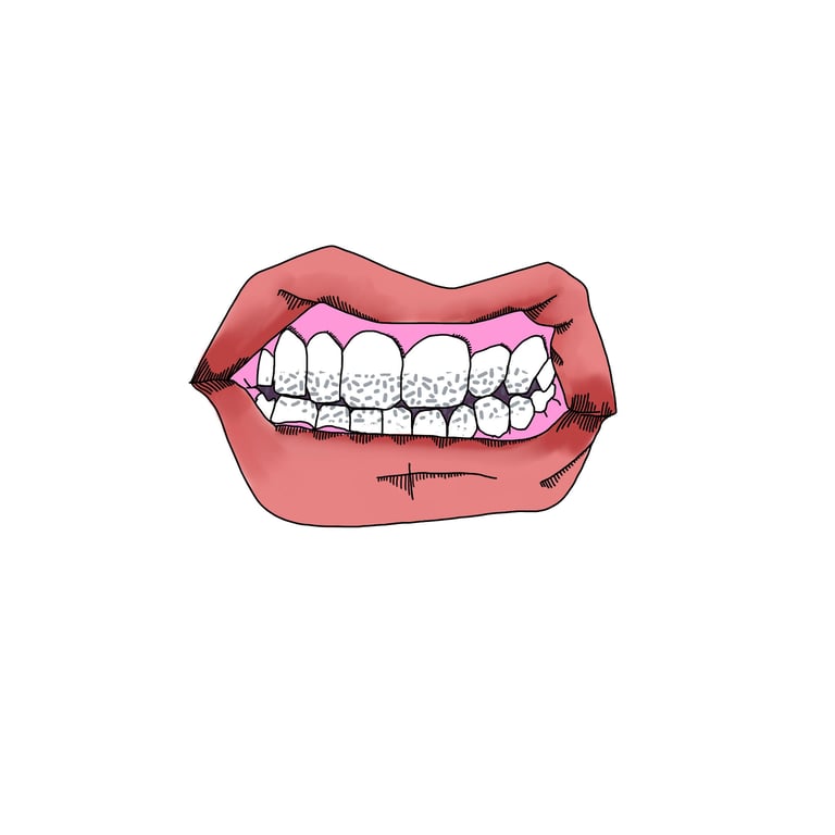 Illustration of a mouth biting down on grey grit, showing how silt feels gritty between the teeth.